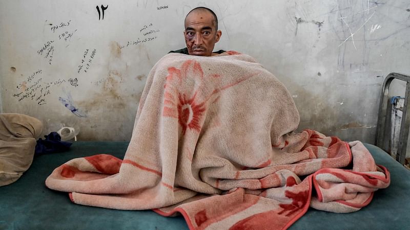 This picture taken on 10 October, 2021 shows a drug addict sitting on his bed at a detoxification ward of the Avicenna Medical Hospital for Drug Treatment in Kabul