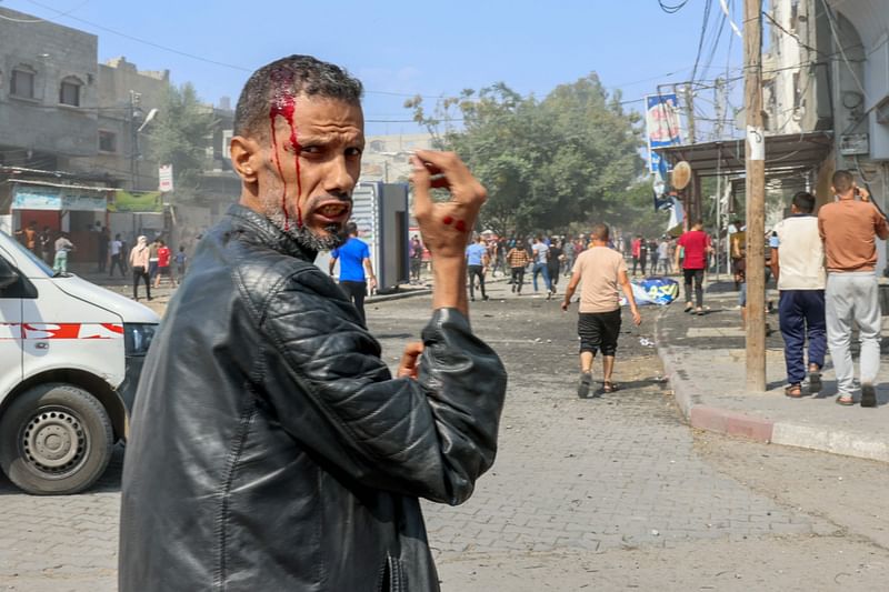 A Palestinian man injured in an Israeli air strike gestures as people inspect the damage in Rafah in the southern Gaza Strip, on 11 October, 2023.