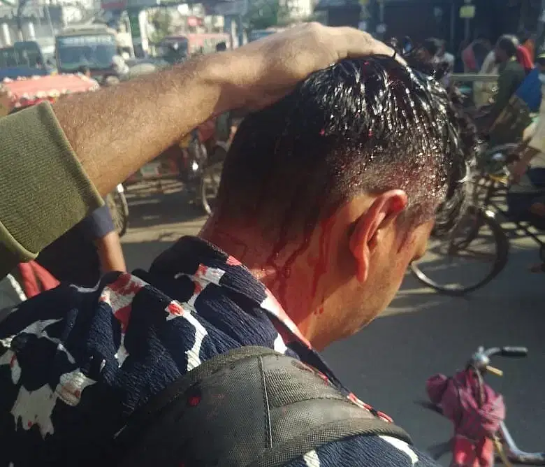 A man sustained head injury during the clash at Science Lab area on 20 November, 2024.