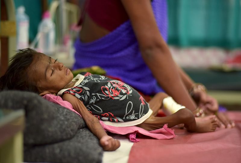 A child lies in a bed in a malnutrition intensive care unit in a medical college