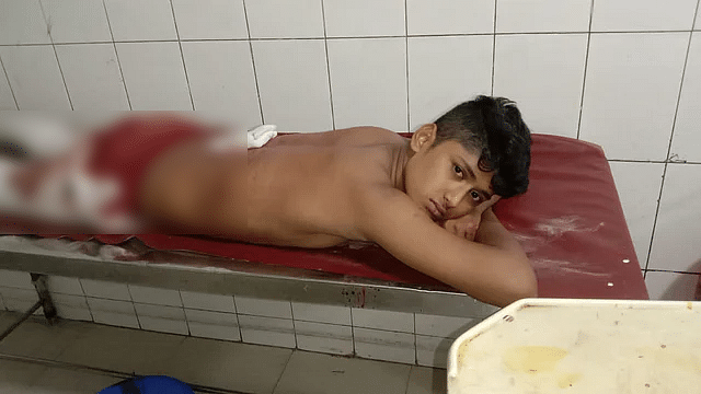 ছুরিকাঘাতে আহত রাকিবুল হাসান শনিবার সকালে অ্যাম্বুলেন্সে করে এসএসসির পরীক্ষা হলে গিয়েছিল। কিন্তু অসুস্থ হয়ে পড়ায় তার আর পরীক্ষা দেওয়া হয়নি