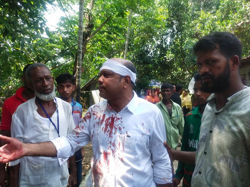 ভোট দিয়ে বের হওয়ার পর এই ভোটারের মাথা ফাটিয়ে দেন প্রতিপক্ষের লোকজন। এ সময় সড়কে অবরোধ করা হয়। আজ সকাল ১০টায় পটিয়ার পূর্ব পিঙ্গলা সরকারি প্রাথমিক বিদ্যালয় কেন্দ্রেপ্রথম আলো