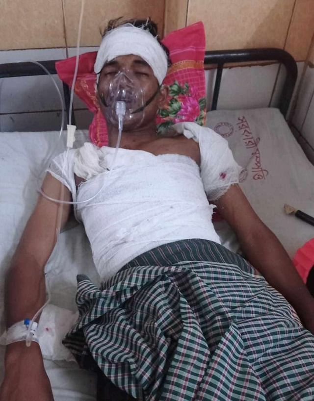 বৈষম্যবিরোধী ছাত্র আন্দোলন চলাকালে গুলিবিদ্ধ হওয়ার পর হাসপাতালে চিকিৎসাধীন শিক্ষার্থী মেহেদী হাসান
