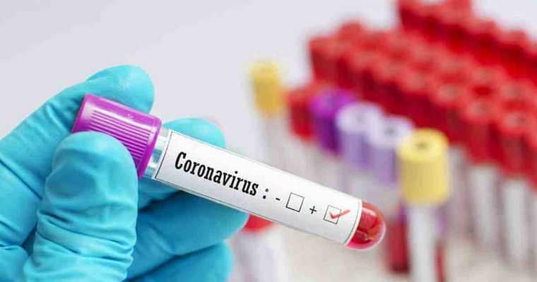 COVID-19 test kit.