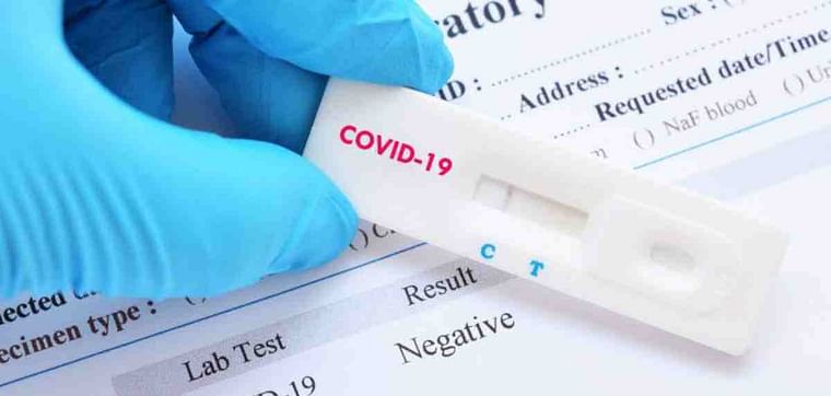 Coronavirus test kit