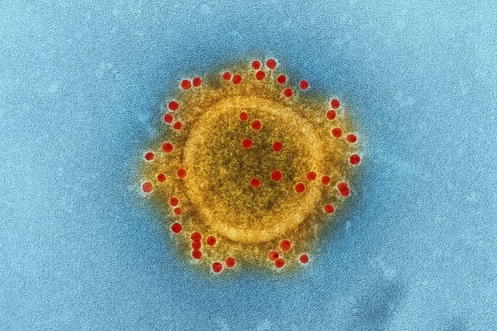An illustration of coronavirus