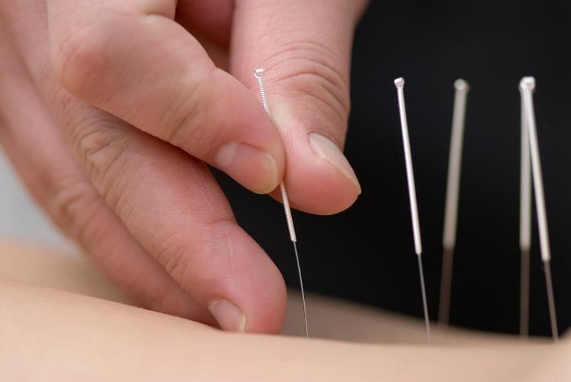 Acupuncture can bring significant improvements in fatigue, anxiety and depression in as little as eight weeks for early stage breast cancer patients, a study shows. File photo