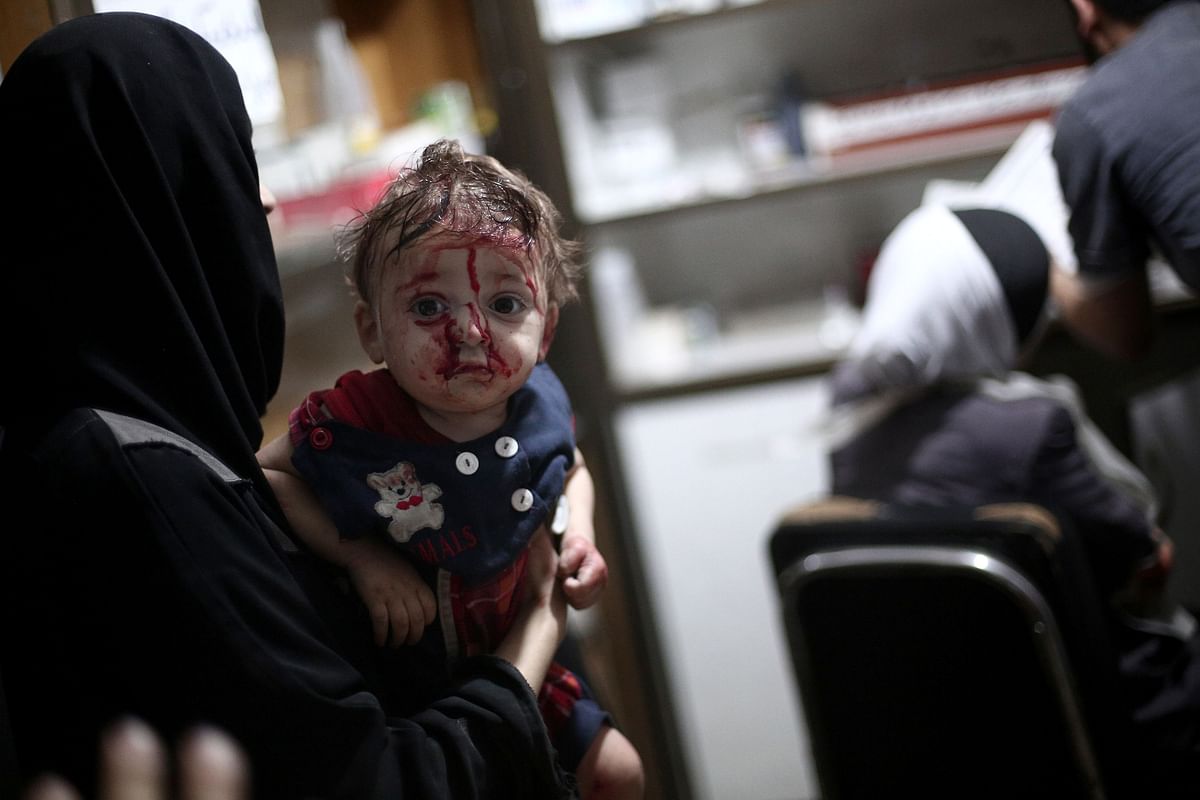 An injured child waits to treat at a makeshift hospital following reported shelling by Syrian government forces in Douma, northeast of Damascus. Photo: AFP