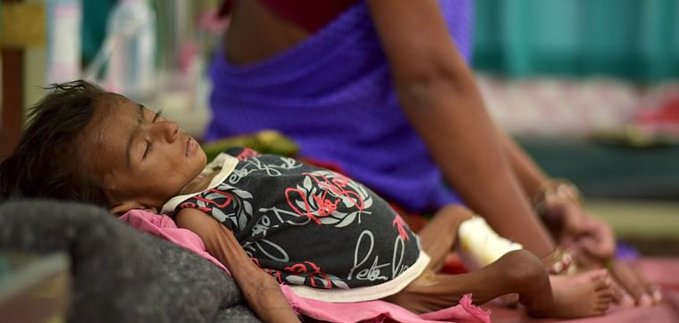 A child lies in a bed in a malnutrition intensive care unit in a medical college