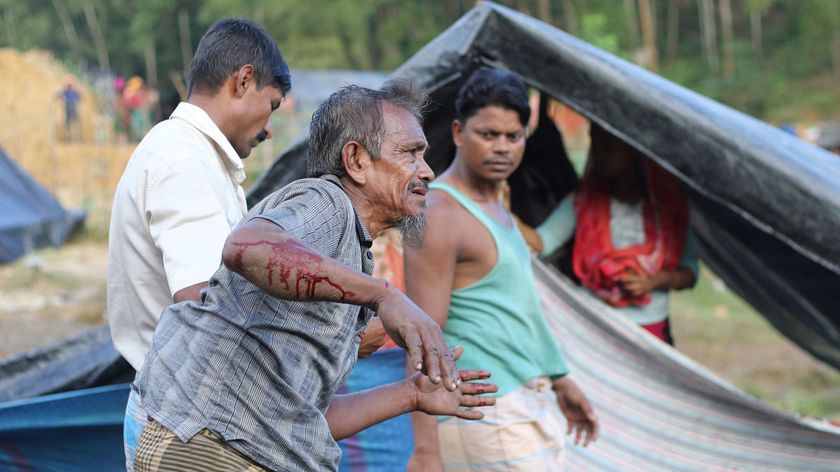 Elderly Rohingya man recently hit by a vehicle while collecting relief at Ukhia, Cox’s Bazar. Photo: Abdus Salam