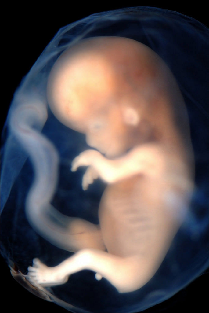 Embryo week 9-10. Photo: Flickr