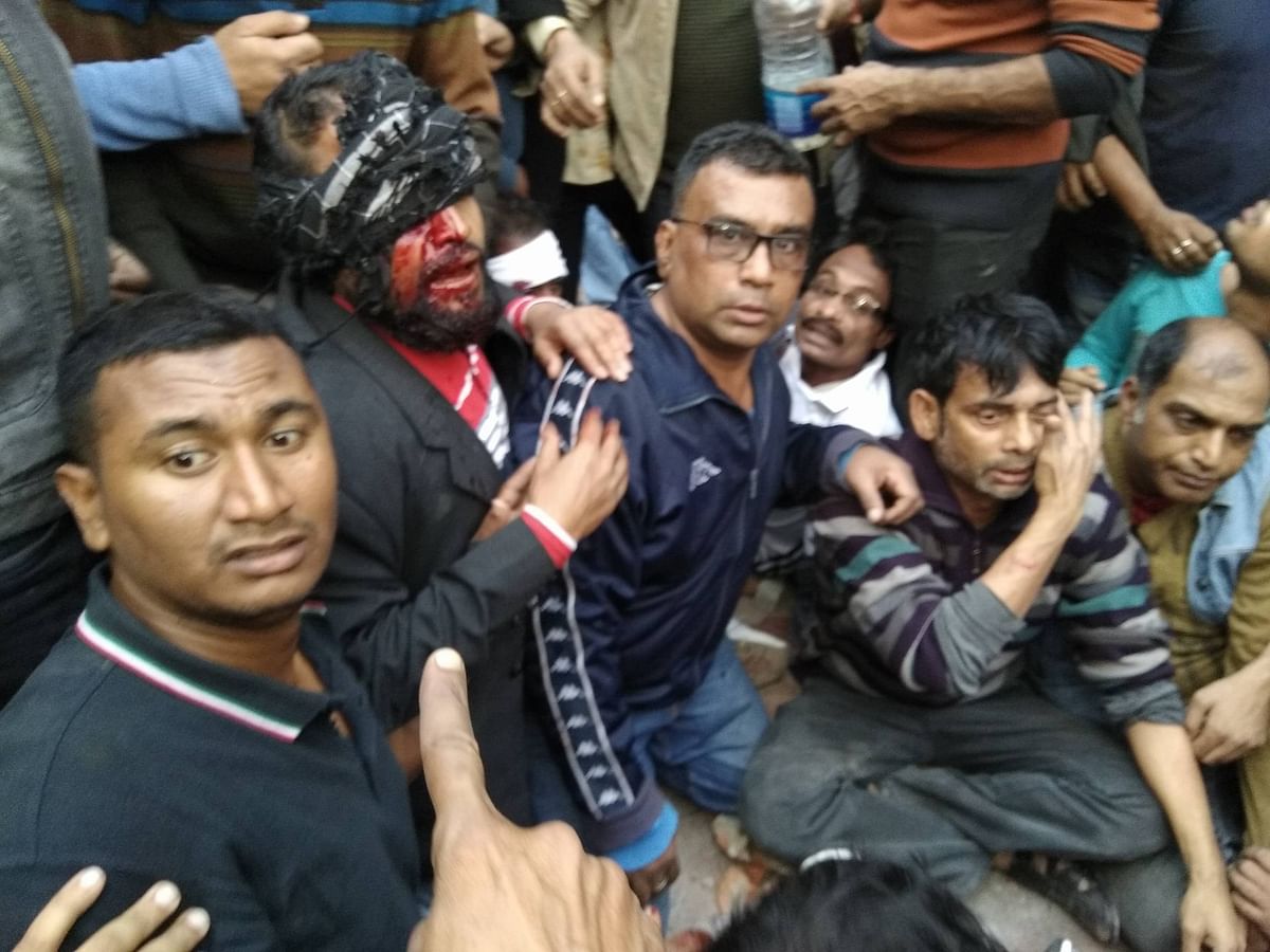 Ten people including journalists suffer injuries after they are hit by brick chips at Chashara of Narayanganj on Tuesday afternoon. Photo Mahbubul Alam