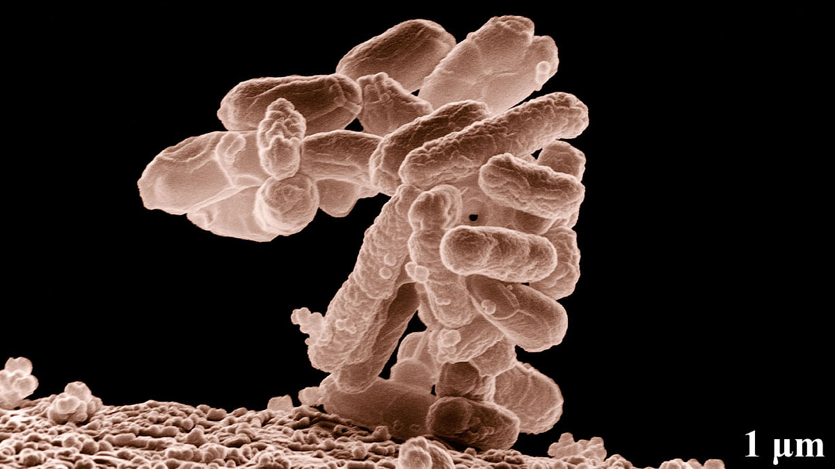 Gut bacteria may increase obesity risk. Photo: Wikipedia