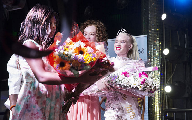 Zimbabwe`s first Miss Albino Sithembiso Mutukura (R) receives a bouquet of flowers after receiving her crown during the inaugural Miss Albinism beauty contest, early on 17 March 2018, in Harare. AFP