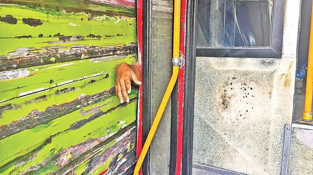 Rajib Hossain`s hand is severed in a collision between two buses at Karwan Bazar area in the capital on Tuesday. Photo: Mizanur Rahman Khan