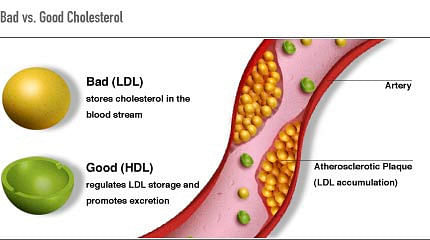 Good cholesterol and bad cholesterol. Photo: Collected