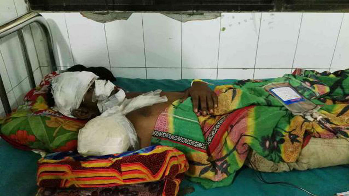 Khalid Hasan Ridoy, 20, who lost his hand in road accident, is undergoing treatment at Dhaka Medical College hospital