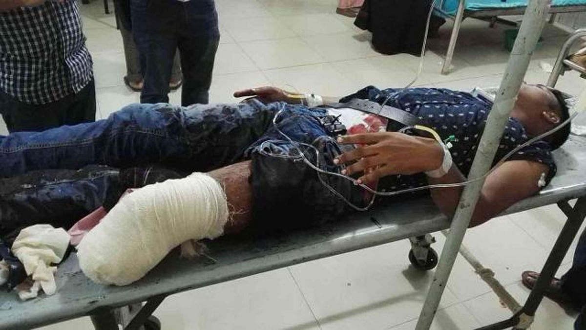 Rasel Sarker, 23, lost his left leg as a speedy bus ran him over in Jatrabari area on Saturday afternoon. Photo: Collected.