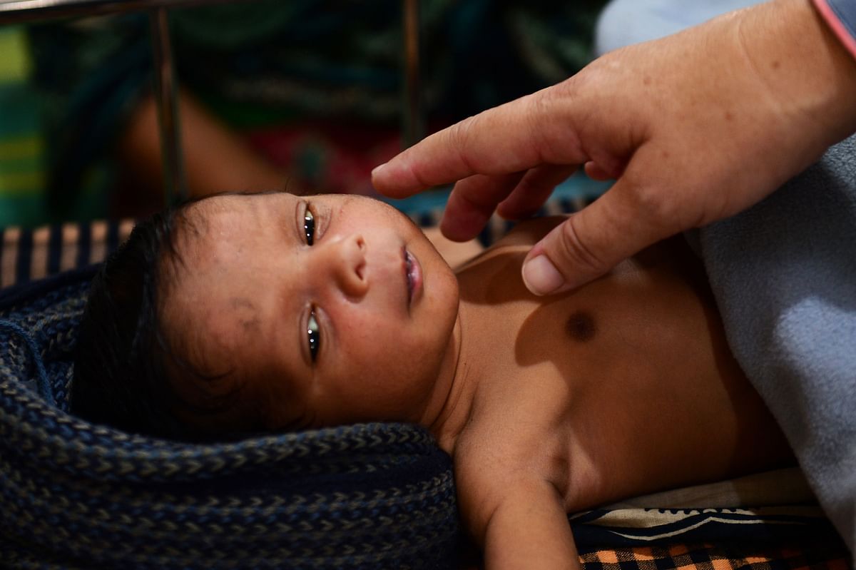 This photograph taken on 9 April 2018, shows a sick child being treated at a Doctors Without Borders (MSF) clinic, at Kutupalong refugee camp in Bangladesh`s Ukhia district. Photo: AFP