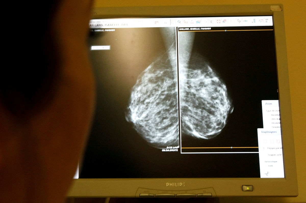 A doctor exams mammograms, as part of a regular cancer prevention medical check-up at a clinic in Nice, south eastern France, 4 January 2008. Photo: Reuters