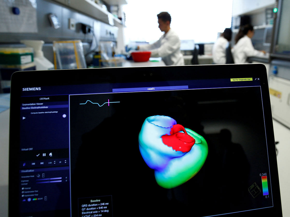 Monitor shows a three-dimensional image of a human heart at the Klaus-Tschira-Institute for Integrative Computational Cardiology, department of the Heidelberg University Hospital (Universitaetsklinikum Heidelberg), in Heidelberg, Germany on 14 August. Photo: Reuters
