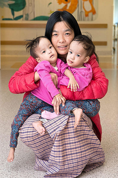 This handout from the Royal Children`s Hospital taken on 4 October 2018 and released on 8 November 2018 shows conjoined twins Dawa (L) and Nima (R) with their mother Bhumchu Zangmo at the hospital in Melbourne. Photo: AFP