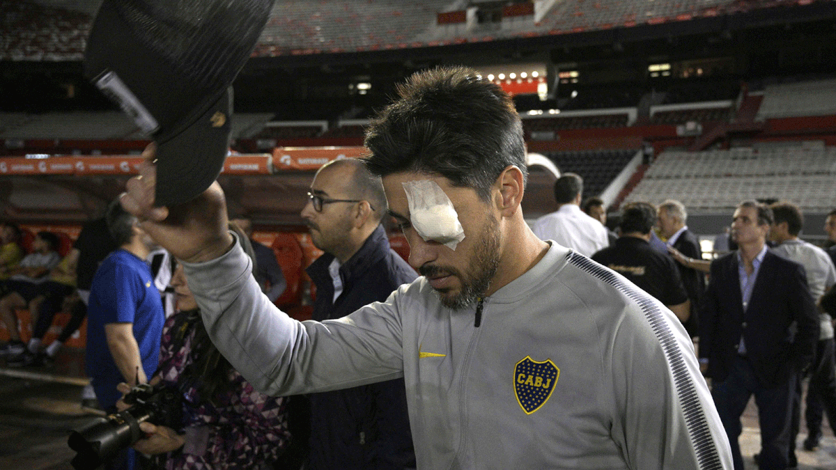 Boca Juniors` Pablo Perez is seen on the field of the Monumental stadium in Buenos Aires with an eye covered after authorities postponed the all-Argentine Copa Libertadores second leg final match against River Plate until Sunday following an attack on the Boca team bus that left players affected by smoke inhalation and broken glass, on 24 November 2018. Photo: AFP