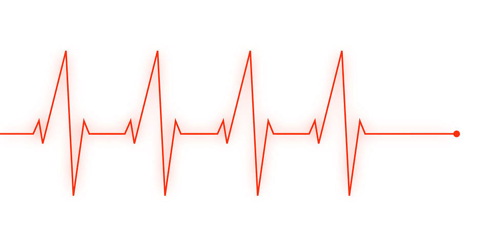Heartbeat image collected