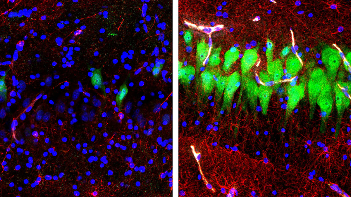 A handout photo made available on 17 April 2019 by the Nature press service shows immunofluorescent stains for neurons (green), astrocytes (red), and cell nuclei (blue) in the hippocampal CA3 region of the brain which was either left untreated for 10 hours after death (left) or subjected to perfusion with the BrainEx technology (right) as a new study reviels that scientists managed to preserve brain function in pigs, 10 hours after they had their heads chopped off. Photo: AFP