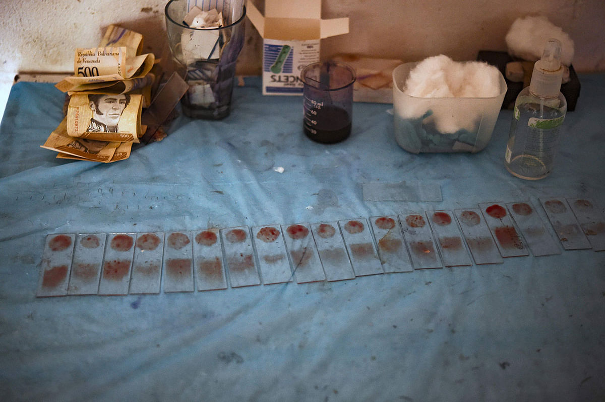 View of blood tests from Yukpa natives suspected of having malaria, at an improvised laboratory of Los Angeles del Tukuko mission, near Machiques, Zulia state, Venezuela on 12 June 2019. Photo: AFP
