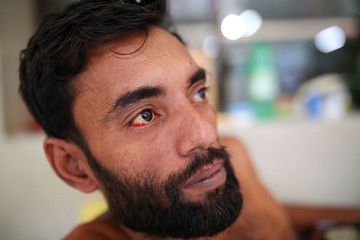 Blood clot is seen in the eye of a dengue-infected patient who is hospitalised at the Shaheed Suhrawardy Medical College and Hospital in Dhaka, Bangladesh, 2 August 2019. Photo: Reuters