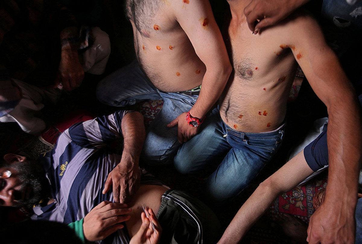 Men with pellet injuries are treated inside a house in a neighbourhood where there have been regular clashes with Indian security forces following restrictions after the government scrapped the special constitutional status for Kashmir, in Srinagar 14 August. Photo: Reuters