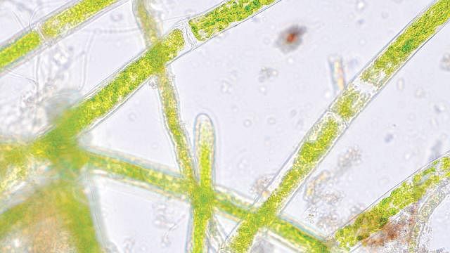 Pithophora through microscope.
