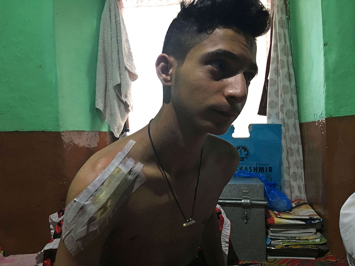 In this photo taken on 6 September 2019, Burhan Nazir Parrey, 16, sits with bandaging on his shoulder a month after he says he was shot with a pellet-firing shotgun by an Indian paramilitary soldier at point blank range in Srinagar. Locals accuse Indian security forces of being responsible for four deaths since New Delhi stripped Kashmir of its autonomy and imposed a crippling lockdown on 5 August. Photo: AFP