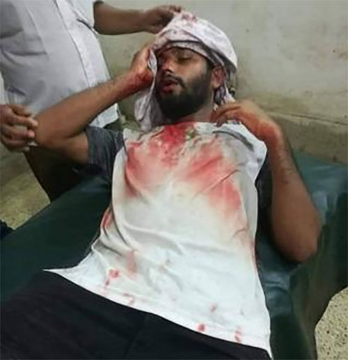 An injured student being treated in Gopalganj General Hospital. Photo taken from Facebook