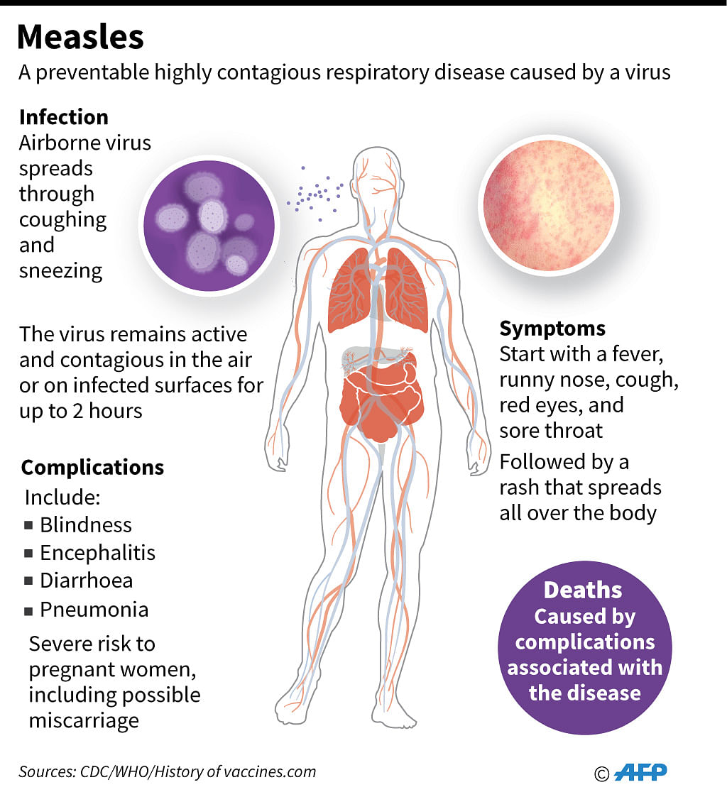Factfile on measles. Photo: AFP