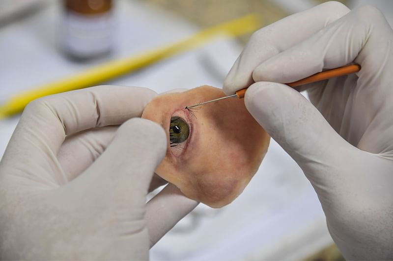 Doctor Rodrigo Salazar-Gamarra works on a digitally-engineered prosthesis for Denise Vicentin, a woman who lost her right eye and part of her jaw to cancer, in Sao Paulo, Brazil, on 3 December 2019. Photo: AFP