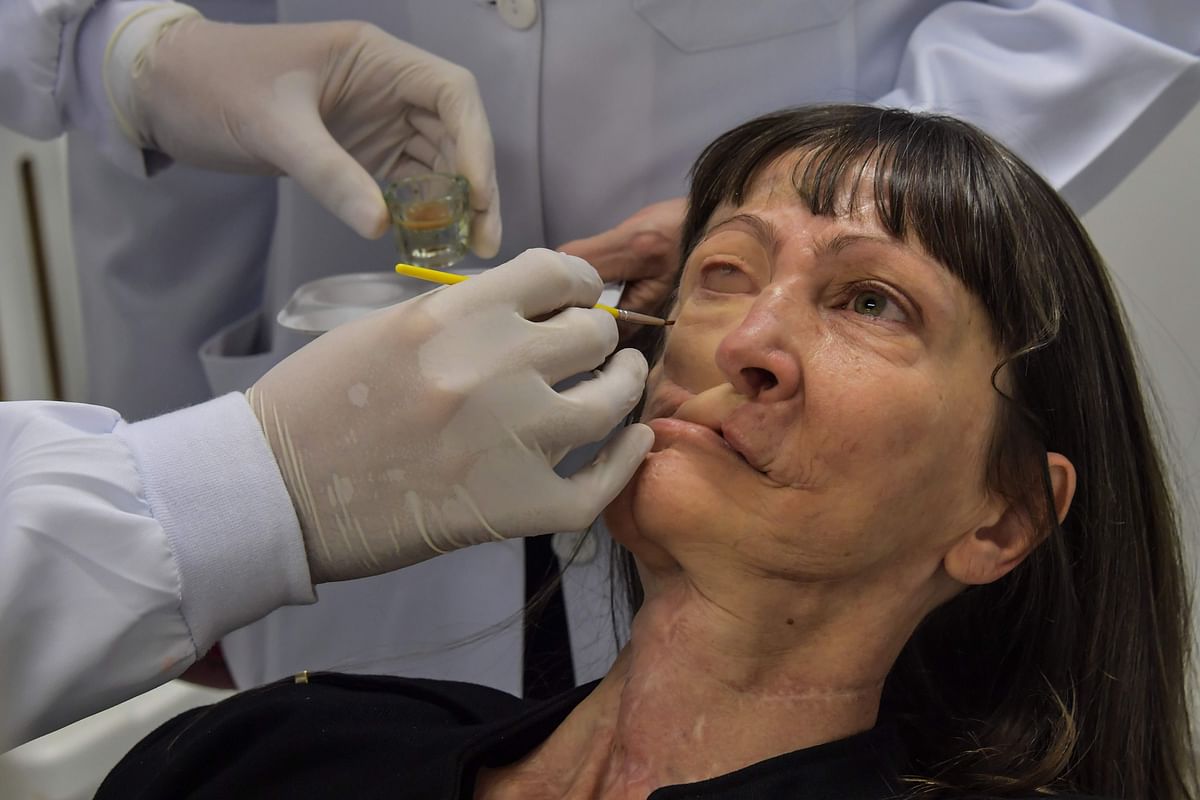 Doctor Rodrigo Salazar-Gamarra places a digitally-engineered prosthesis on Denise Vicentin, a woman who lost her right eye and part of her jaw to cancer, in Sao Paulo, Brazil, on 3 December 2019. Photo: AFP