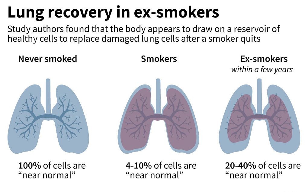 Graphic showing the extent to which an ex-smoker`s lungs can recover after quitting the habit, according to new research published Wednesday. Photo: AFP