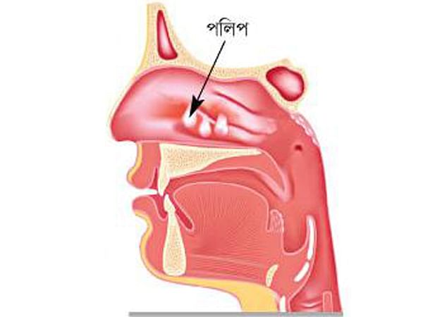 সব প ণ ডই ন ক র পল প নয প রথম আল